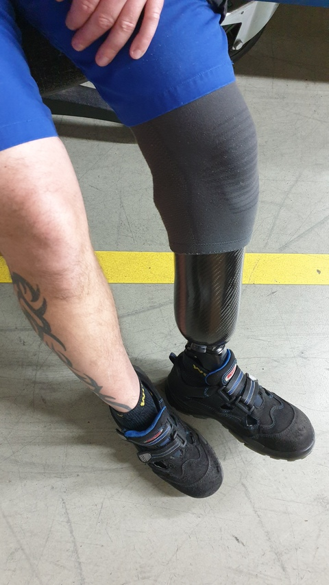 OnlyFans Titelbild amputee_leg39