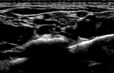 OnlyFans हेडर तस्वीर fr8siren