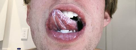 OnlyFans üst resmi naughtyzeph